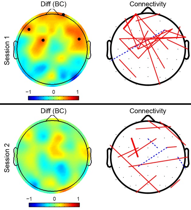 Mid-Task Break Improves Global Integration of Functional Connectivity in Lower Alpha Band